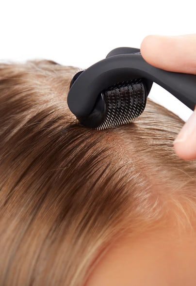 Nine Answers to Your Questions About PRP Therapy for Hair Loss