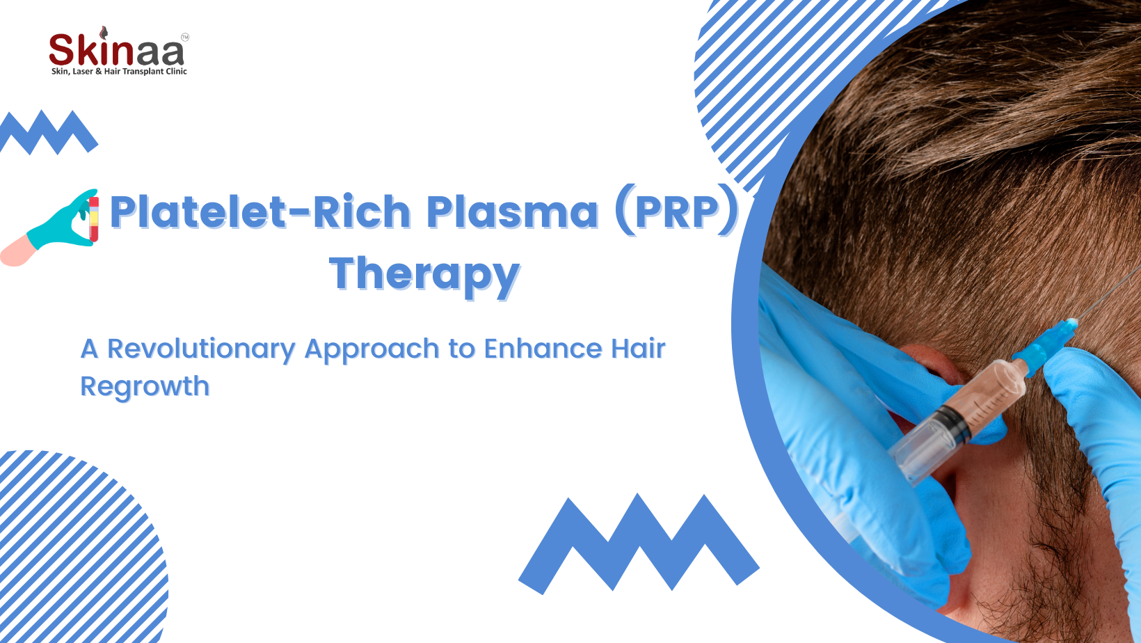 Platelet-Rich Plasma (PRP) Therapy: A Revolutionary Approach to Enhance Hair Regrowth