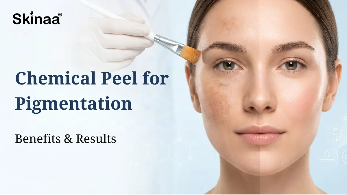 chemical peel for pigmentation