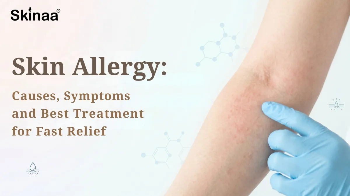 skin allergy