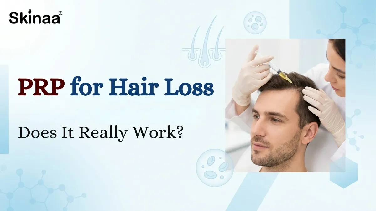 Prp for hair loss