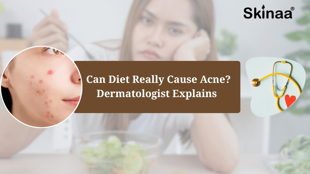 can diet cause acne