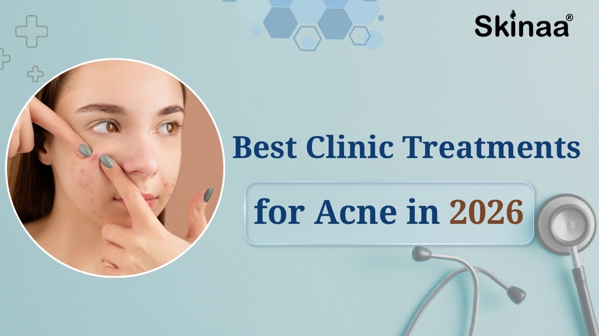 best acne treatment