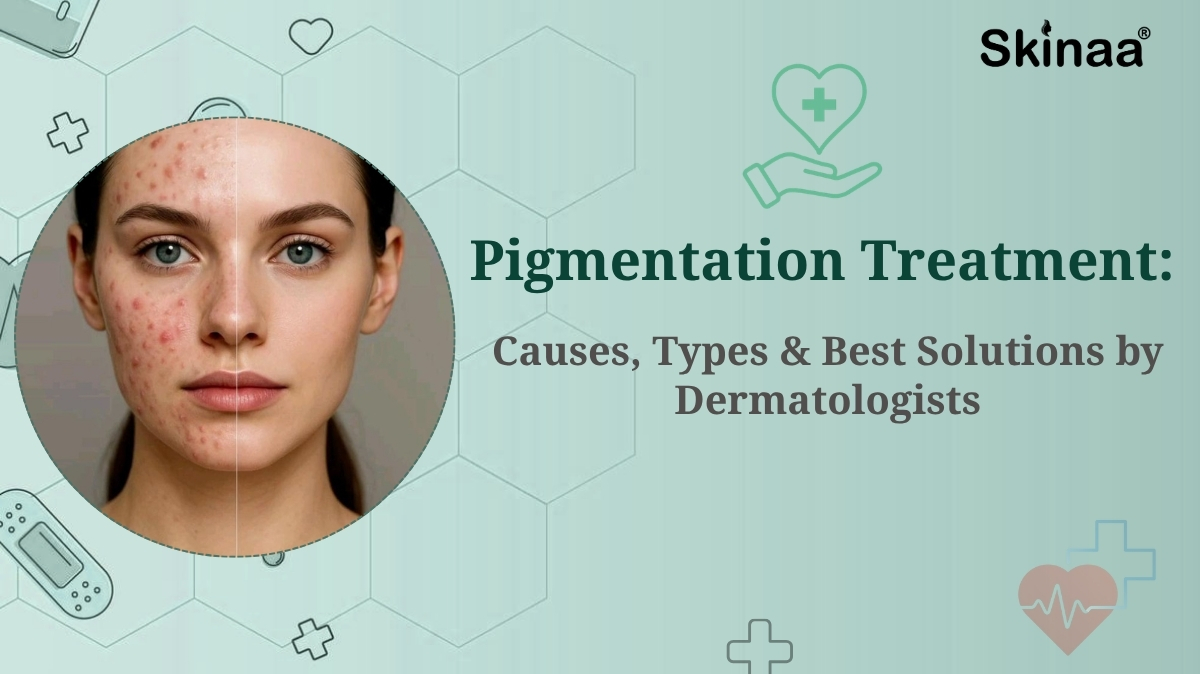 pigmentation treatment