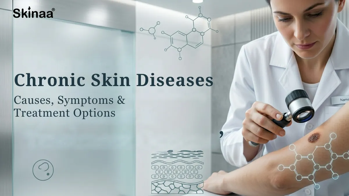 Chronic Skin Diseases: Causes, Symptoms & Treatment Options (Dermatologist Guide)